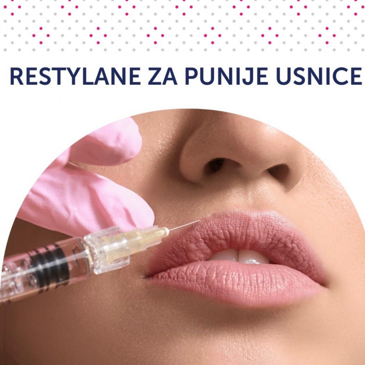 Estetska korekcija osmijeha i lica: koje se metode kombiniraju