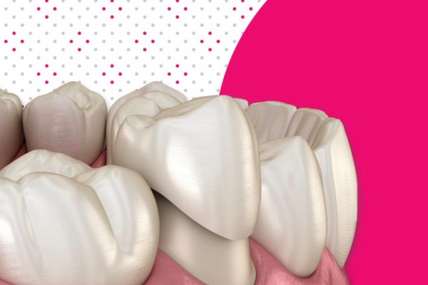 Učinkovita rje&scaron;enja za gubitak zuba